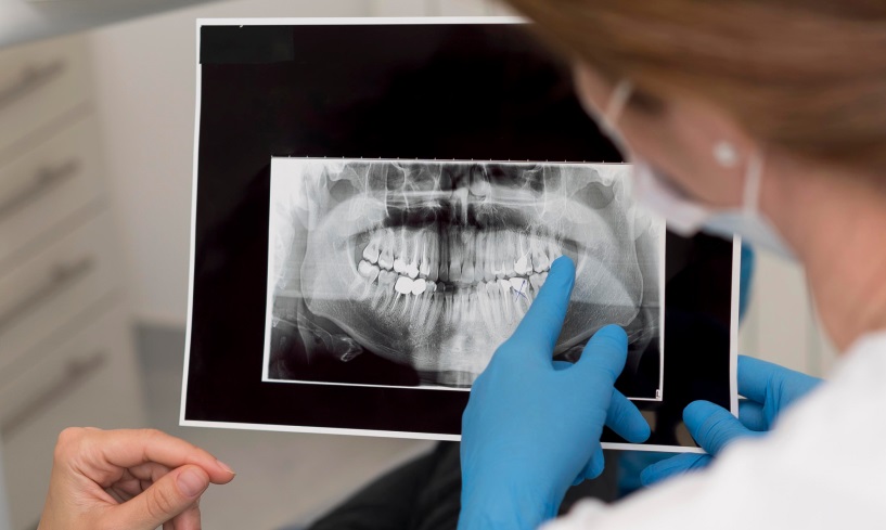 Imagistică Dentară